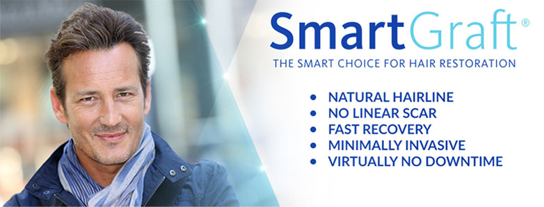 SmartGraft is the Smart Choice for hair restoration. The SmartGraft closed harvesting system provides a more natural-looking hairline with no visible linear scar and a faster recovery. 