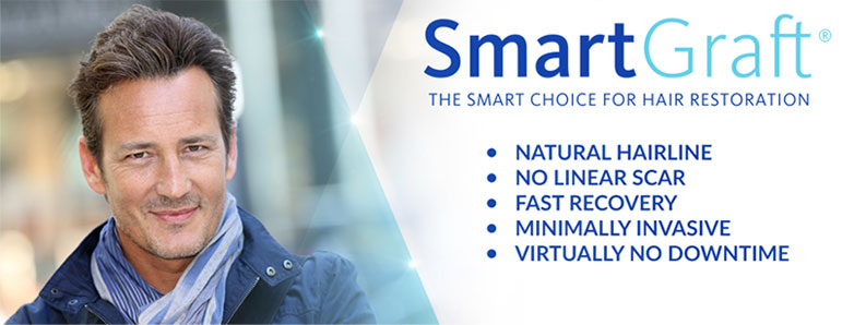 smartgraft-smart-choice