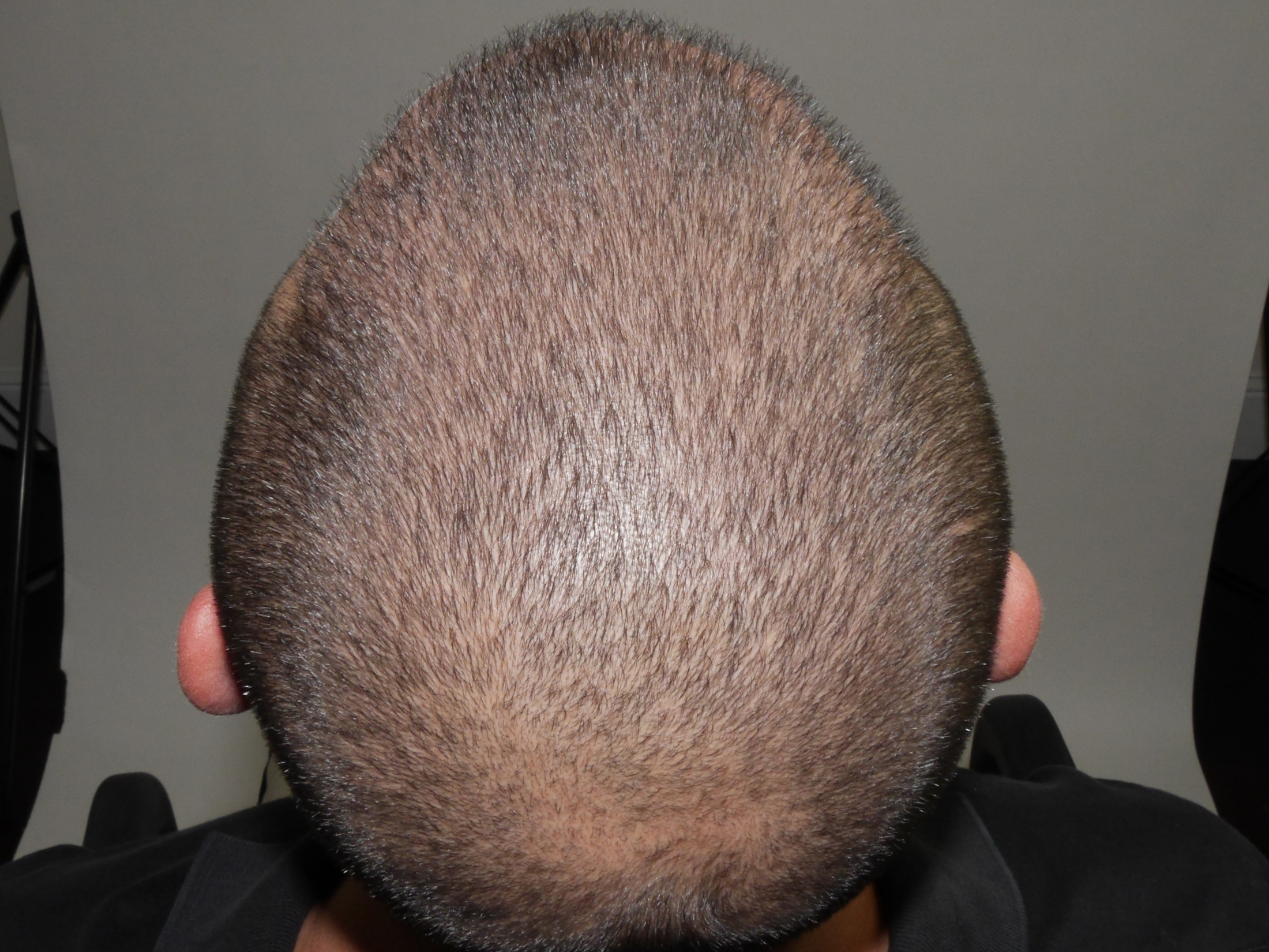 BEFORE
