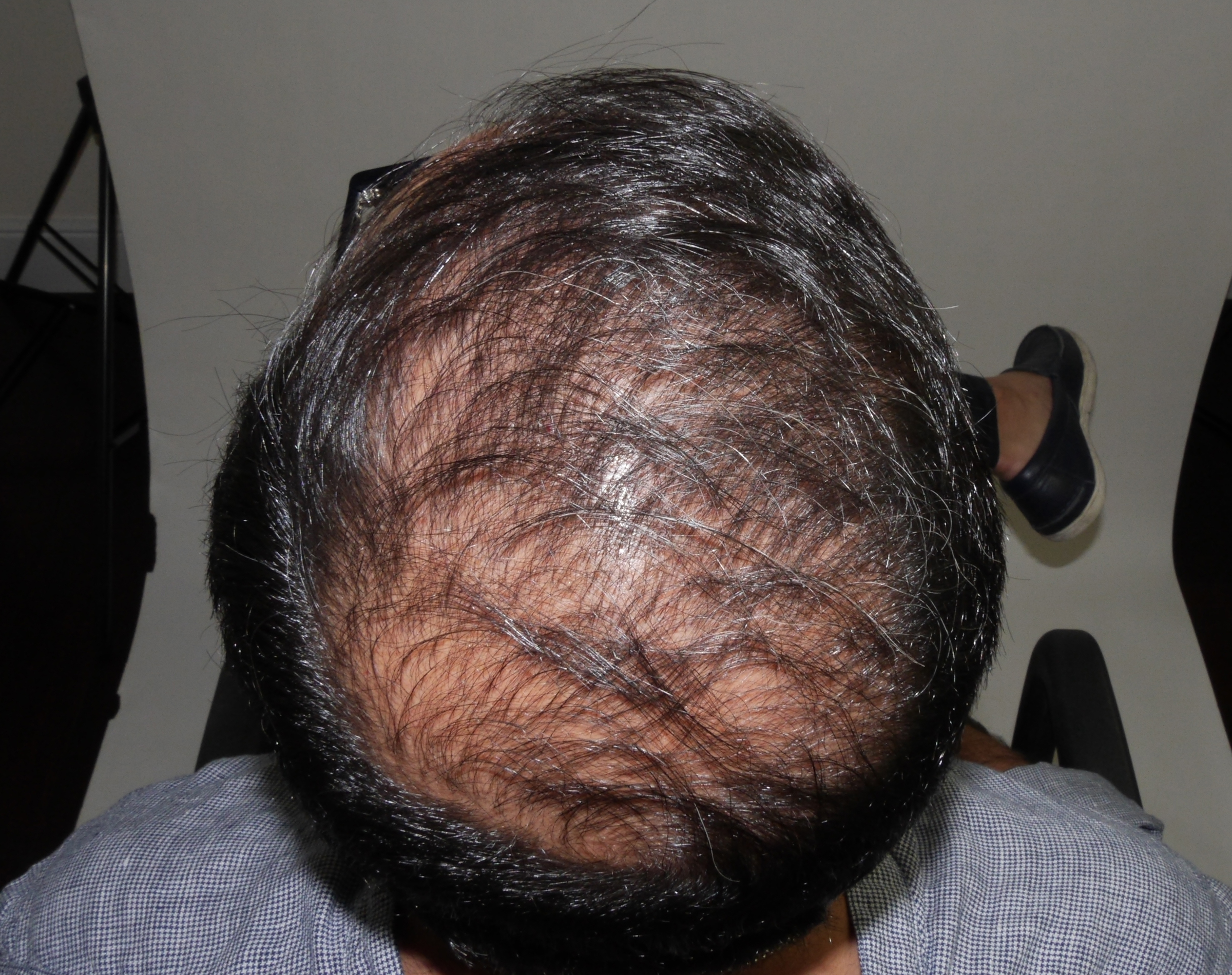 BEFORE