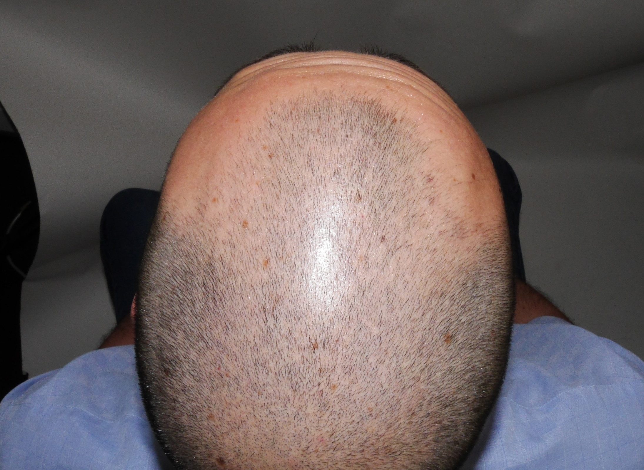 BEFORE