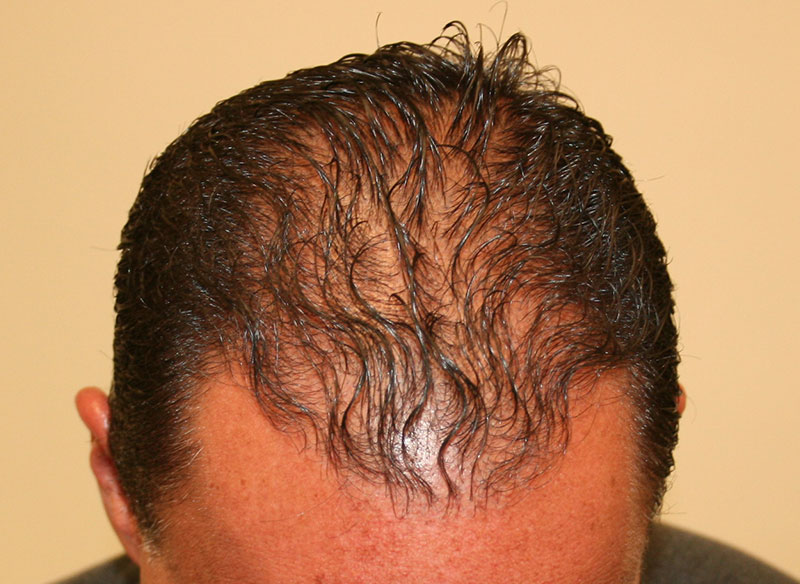 After