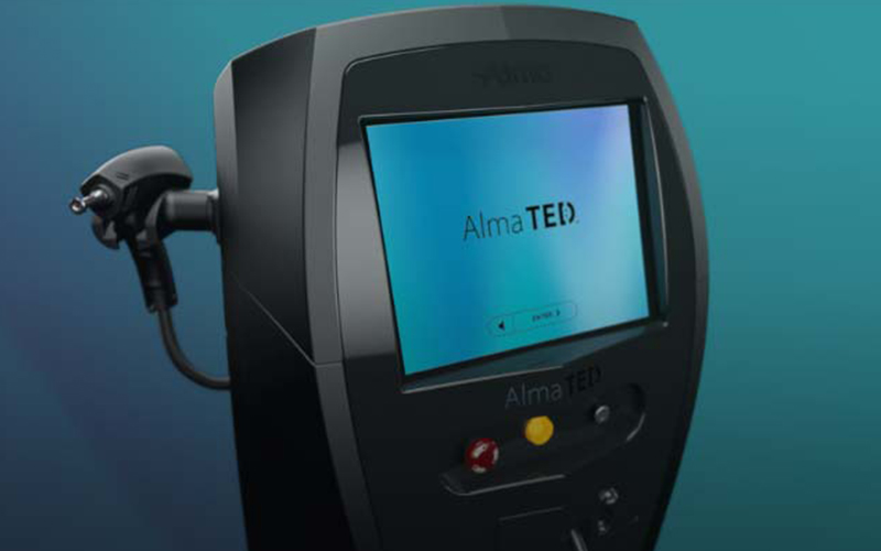 ted-procedure Ted Procedure